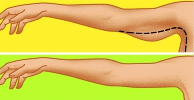 4 exercices simples pour raffermir les bras relâchés