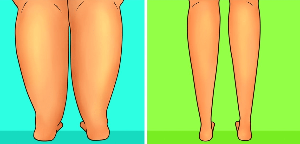 Comment maigrir des cuisses et affiner les jambes