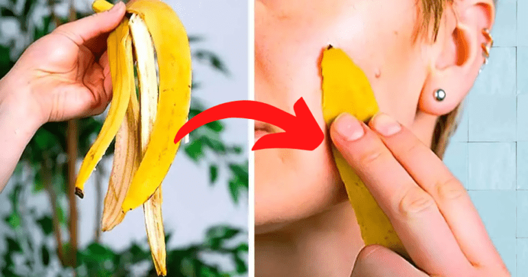 La prochaine fois que vous mangez une banane ne jetez pas la peau