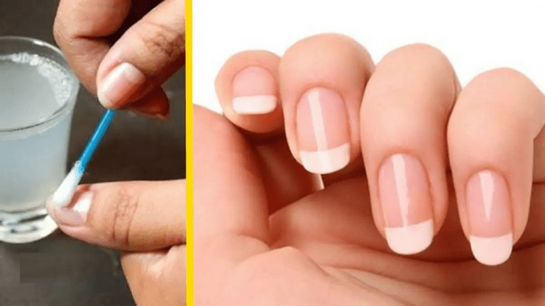 Prévenir les Ongles de Se Casser avec 5 Solutions Naturelles