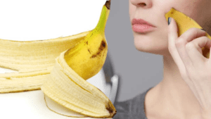 La peau de banane