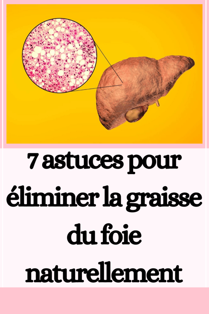 éliminer la graisse du foie naturellement