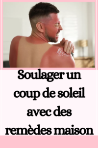 Soulager un coup de soleil