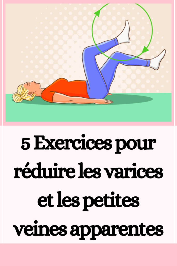 Exercices pour réduire les varices et les petites veines apparentes