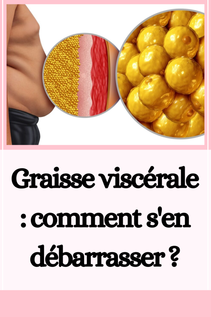 Graisse viscérale