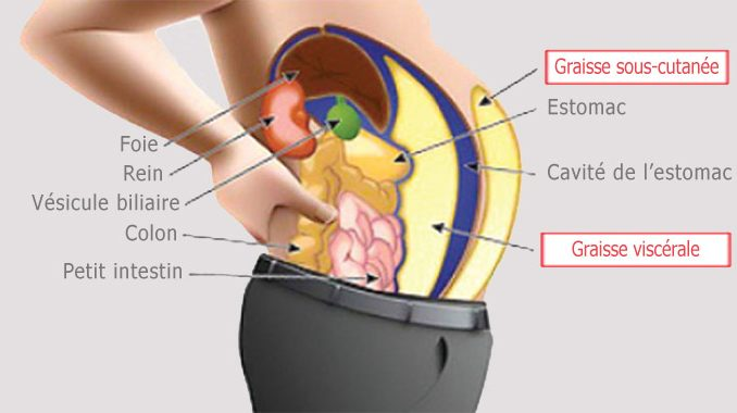 Graisse viscérale